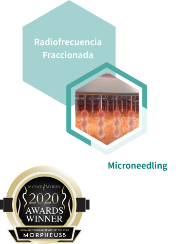 La combinación perfecta de Radiofrecuencia Fraccionada y Microneedling para rejuvenecer la piel
